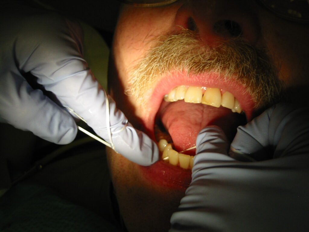 A Guide to Flossing Your Teeth - Dentist - Minneapolis Dental, MN