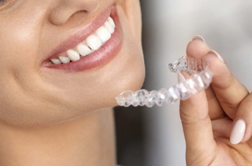 teeth whitening