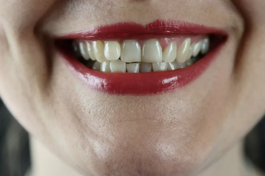 SMILING TEETH