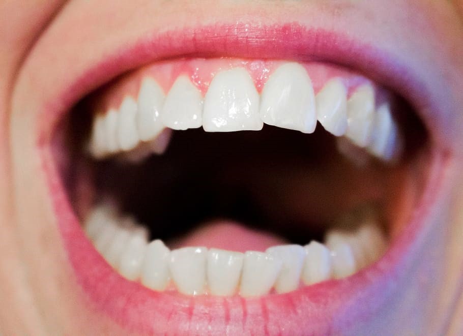 DENTAL CROWNS