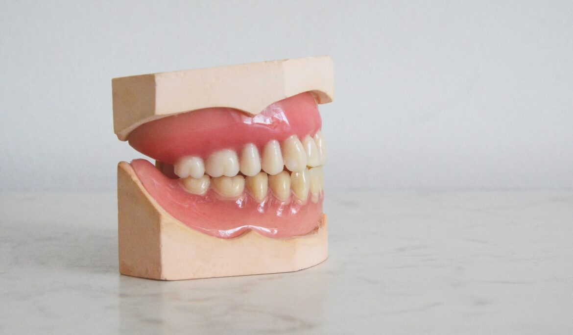 Teeth whitening