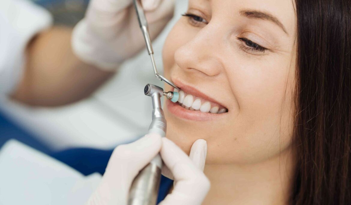 dental veneers